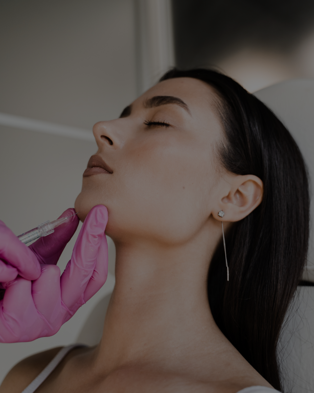 Dermal Fillers