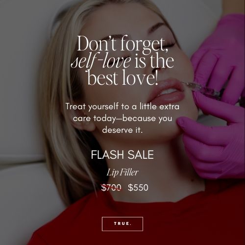 Pout Perfection: $150 Off Lip Filler Special!