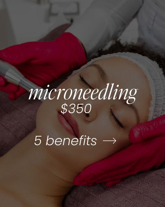 Microneedling