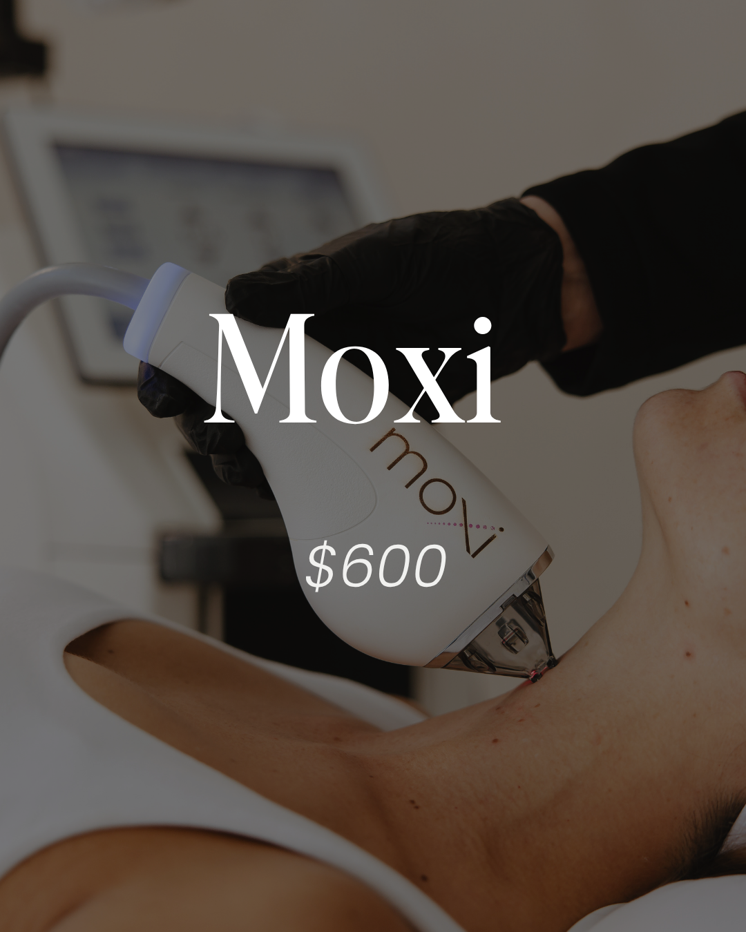 MOXI® – Gentle Laser for Glowing, Healthy Ski
